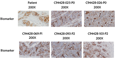 Patient Derived Xenograft Models
